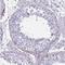 Glutaredoxin And Cysteine Rich Domain Containing 2 antibody, NBP2-32458, Novus Biologicals, Immunohistochemistry paraffin image 