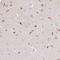 Clavesin 1 antibody, HPA053869, Atlas Antibodies, Immunohistochemistry paraffin image 