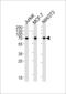 Ribosomal Protein S6 Kinase B2 antibody, LS-C162756, Lifespan Biosciences, Western Blot image 
