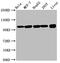 Actinin Alpha 4 antibody, CSB-PA00814A0Rb, Cusabio, Western Blot image 