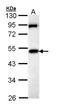 Membrane Palmitoylated Protein 1 antibody, NBP1-33051, Novus Biologicals, Western Blot image 