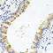 AlkB Homolog 8, TRNA Methyltransferase antibody, abx005393, Abbexa, Western Blot image 