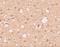 Amyloid Beta Precursor Protein Binding Family A Member 2 antibody, NBP2-41127, Novus Biologicals, Immunohistochemistry frozen image 