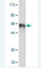 SIX Homeobox 2 antibody, H00010736-M02, Novus Biologicals, Western Blot image 