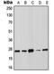 Suppressor Of Cytokine Signaling 3 antibody, orb214849, Biorbyt, Western Blot image 