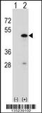 RNA Binding Motif Protein 22 antibody, 58-086, ProSci, Western Blot image 