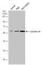 Coronin 1A antibody, PA5-78358, Invitrogen Antibodies, Western Blot image 