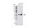 LCK Proto-Oncogene, Src Family Tyrosine Kinase antibody, 2984S, Cell Signaling Technology, Western Blot image 