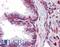 Metadherin antibody, LS-B4118, Lifespan Biosciences, Immunohistochemistry frozen image 
