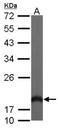 Hippocalcin Like 1 antibody, NBP2-14988, Novus Biologicals, Western Blot image 