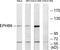 EPH Receptor B6 antibody, TA313837, Origene, Western Blot image 