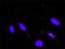 F-Box And WD Repeat Domain Containing 11 antibody, H00023291-M03, Novus Biologicals, Proximity Ligation Assay image 