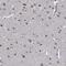 Cytoplasmic tRNA 2-thiolation protein 2 antibody, HPA041135, Atlas Antibodies, Immunohistochemistry frozen image 