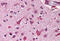 MCL1 Apoptosis Regulator, BCL2 Family Member antibody, MBS240333, MyBioSource, Immunohistochemistry frozen image 