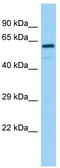 RALBP1 Associated Eps Domain Containing 2 antibody, TA338177, Origene, Western Blot image 