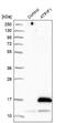 ATP Synthase Inhibitory Factor Subunit 1 antibody, NBP1-90069, Novus Biologicals, Western Blot image 