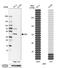 Adenosine Kinase antibody, NBP1-90197, Novus Biologicals, Western Blot image 