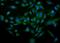 Tyrosine Hydroxylase antibody, PB9449, Boster Biological Technology, Immunofluorescence image 