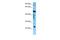 Charged Multivesicular Body Protein 6 antibody, A07419, Boster Biological Technology, Western Blot image 