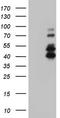Interleukin-1 receptor-associated kinase-like 2 antibody, TA803679S, Origene, Western Blot image 