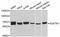 Sequestosome 1 antibody, abx126645, Abbexa, Western Blot image 