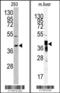 Aldo-Keto Reductase Family 7 Member A2 antibody, 62-713, ProSci, Western Blot image 