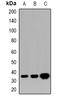Homeobox D13 antibody, orb382479, Biorbyt, Western Blot image 