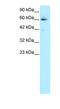 Hematopoietic Cell-Specific Lyn Substrate 1 antibody, 27-445, ProSci, Western Blot image 