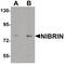 Nibrin antibody, PA5-34385, Invitrogen Antibodies, Western Blot image 