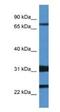 Potassium Voltage-Gated Channel Subfamily D Member 1 antibody, NBP1-74103, Novus Biologicals, Western Blot image 