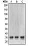 Carbonyl Reductase 1 antibody, orb213674, Biorbyt, Western Blot image 