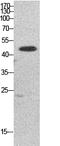 Eukaryotic Translation Elongation Factor 1 Alpha 1 antibody, STJ96859, St John