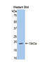 Hexokinase 1 antibody, LS-C297232, Lifespan Biosciences, Western Blot image 