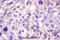 Mitogen-Activated Protein Kinase Kinase Kinase 8 antibody, A01696-1, Boster Biological Technology, Immunohistochemistry frozen image 