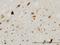 Pleiotrophin antibody, H00005764-M02, Novus Biologicals, Immunohistochemistry paraffin image 