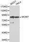 Minichromosome Maintenance Complex Component 7 antibody, LS-C192389, Lifespan Biosciences, Western Blot image 