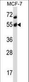 AKT Serine/Threonine Kinase 2 antibody, LS-B11820, Lifespan Biosciences, Western Blot image 