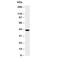 Hydroxysteroid 17-Beta Dehydrogenase 2 antibody, R30683, NSJ Bioreagents, Western Blot image 
