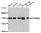Kringle Containing Transmembrane Protein 1 antibody, A10507, ABclonal Technology, Western Blot image 