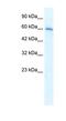 Cholinergic Receptor Nicotinic Alpha 7 Subunit antibody, NBP1-80092, Novus Biologicals, Western Blot image 