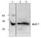 Activin A Receptor Type 1C antibody, NBP1-50659, Novus Biologicals, Western Blot image 