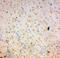 Superoxide Dismutase 2 antibody, LS-C312936, Lifespan Biosciences, Immunohistochemistry paraffin image 