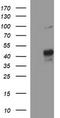 Matrix Metallopeptidase 13 antibody, LS-C788301, Lifespan Biosciences, Western Blot image 