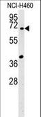 Synapsin III antibody, LS-C161638, Lifespan Biosciences, Western Blot image 