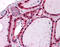 Interleukin 1 Receptor Associated Kinase 1 antibody, 51-475, ProSci, Enzyme Linked Immunosorbent Assay image 