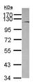 Brevican antibody, ab111719, Abcam, Western Blot image 