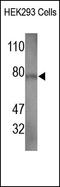 Argonaute RISC Catalytic Component 2 antibody, 251907, Abbiotec, Western Blot image 