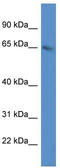 N6-adenosine-methyltransferase 70 kDa subunit antibody, TA337238, Origene, Western Blot image 