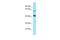 YY2 Transcription Factor antibody, A10206, Boster Biological Technology, Western Blot image 