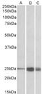 Troponin I2, Fast Skeletal Type antibody, LS-C186613, Lifespan Biosciences, Western Blot image 